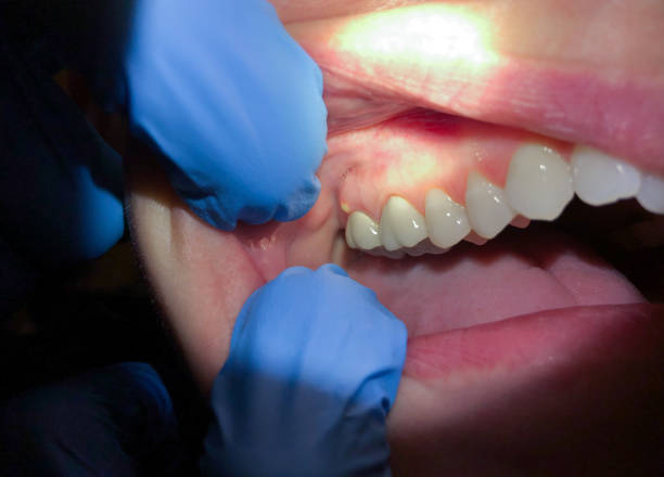 Best Pediatric Emergency Dentist in Yreka, CA