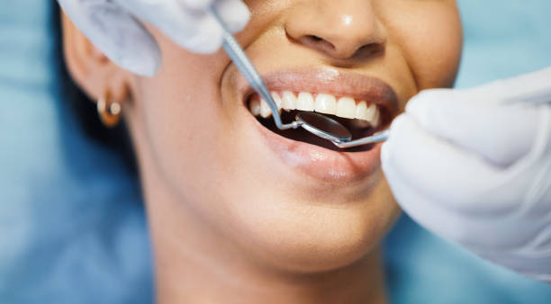 Best Emergency Gum Treatment in Yreka, CA